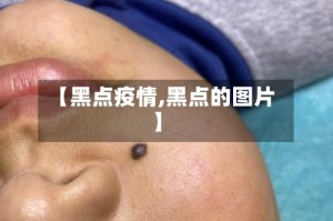 【黑点疫情,黑点的图片】