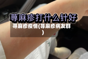 寻麻疹疫情(荨麻疹病友群)