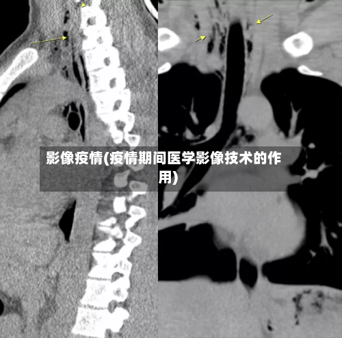 影像疫情(疫情期间医学影像技术的作用)-第1张图片