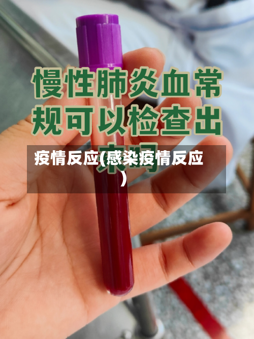 疫情反应(感染疫情反应)-第1张图片